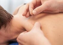 Can Dry Needling Help With Persistent Shoulder Tightness?